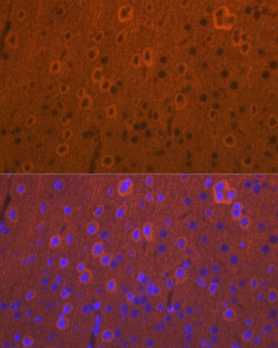 DCAMKL1/DCLK1 Rabbit Polyclonal Antibody - Image 5