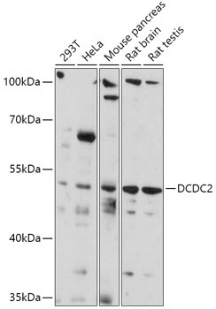 DCDC2 Rabbit Polyclonal Antibody