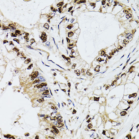 DCK Rabbit Polyclonal Antibody - Image 2