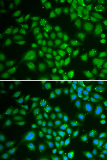 DCK Rabbit Polyclonal Antibody - Image 3