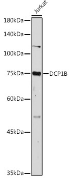 DCP1B Rabbit Polyclonal Antibody - Image 2
