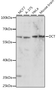 DCT Rabbit Polyclonal Antibody