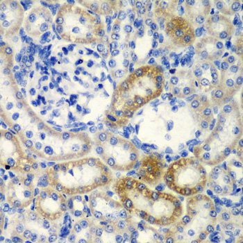 DCTD Rabbit Polyclonal Antibody - Image 2