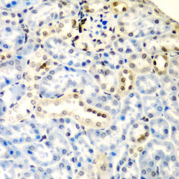 DCTD Rabbit Polyclonal Antibody - Image 3