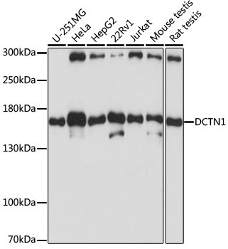 DCTN1 Rabbit Polyclonal Antibody
