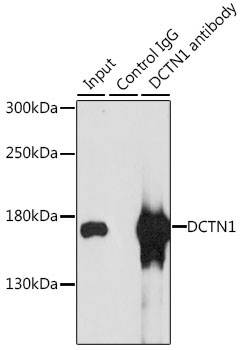 DCTN1 Rabbit Polyclonal Antibody - Image 2