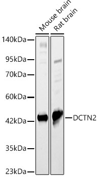 DCTN2 Rabbit Polyclonal Antibody