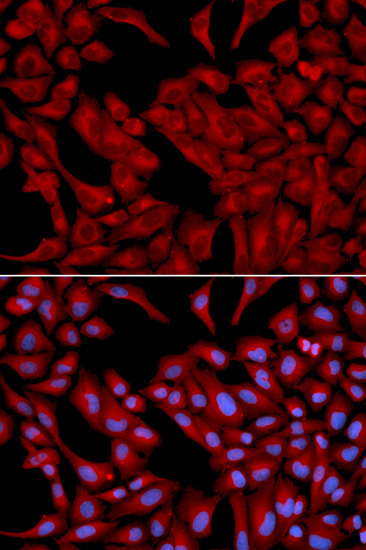 DCTN2 Rabbit Polyclonal Antibody - Image 2