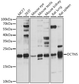 DCTN5 Rabbit Polyclonal Antibody