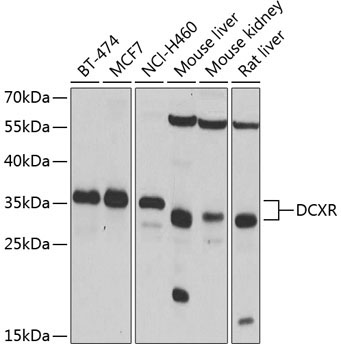 DCXR Rabbit Polyclonal Antibody