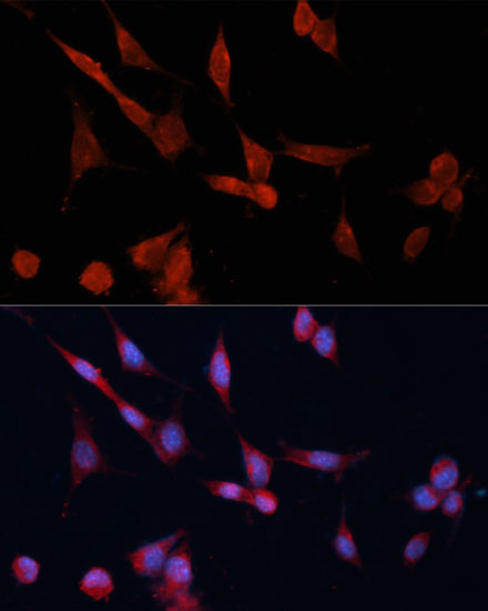 DDAH1 Rabbit Polyclonal Antibody - Image 2