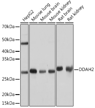 DDAH2 Rabbit Monoclonal Antibody