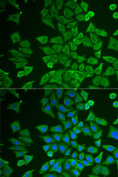 DDAH2 Rabbit Polyclonal Antibody - Image 2
