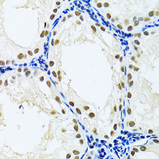 DDB1 Rabbit Polyclonal Antibody - Image 2