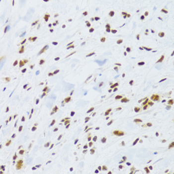 DDB1 Rabbit Polyclonal Antibody - Image 3