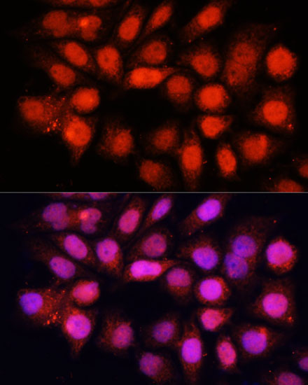 DDB1 Rabbit Polyclonal Antibody - Image 5