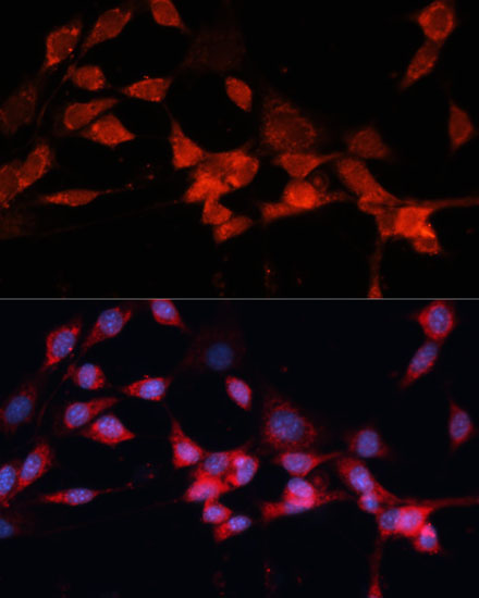 DDB1 Rabbit Polyclonal Antibody - Image 6