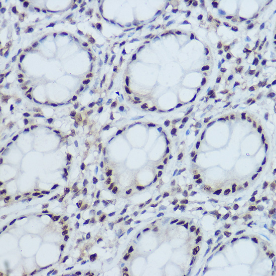 DDB1 Rabbit Polyclonal Antibody - Image 2