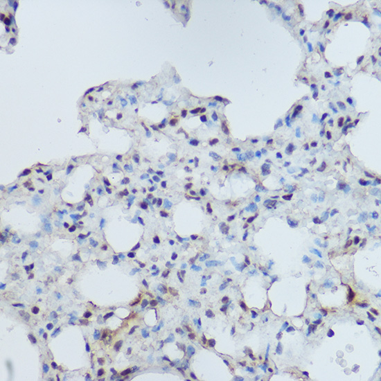 DDB1 Rabbit Polyclonal Antibody - Image 3