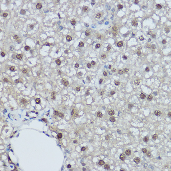 DDB1 Rabbit Polyclonal Antibody - Image 4