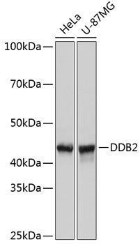 DDB2 Rabbit Monoclonal Antibody