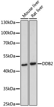 DDB2 Rabbit Polyclonal Antibody