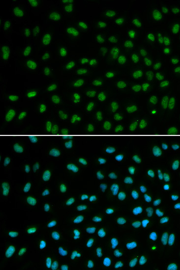 DDB2 Rabbit Polyclonal Antibody