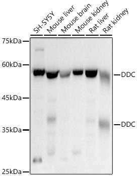 DDC Rabbit Polyclonal Antibody