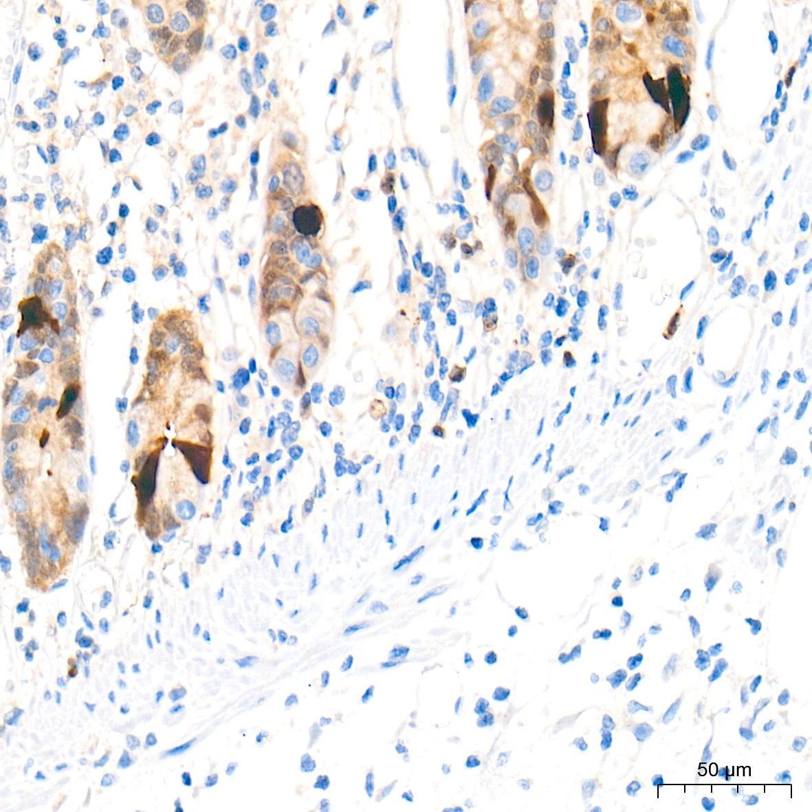 DDC Rabbit Polyclonal Antibody - Image 2