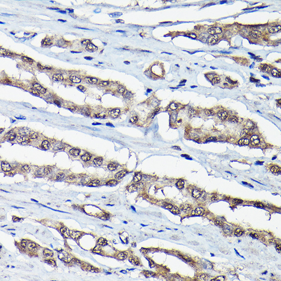 DDIT3/CHOP Rabbit Polyclonal Antibody