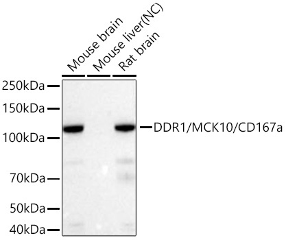 DDR1/MCK10/CD167a Rabbit Monoclonal Antibody