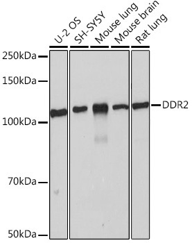 DDR2 Rabbit Monoclonal Antibody