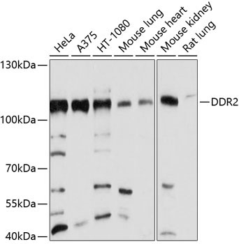 DDR2 Rabbit Polyclonal Antibody