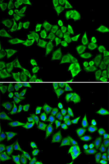 DDX20 Rabbit Polyclonal Antibody - Image 2