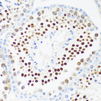 DDX21 Rabbit Polyclonal Antibody - Image 2