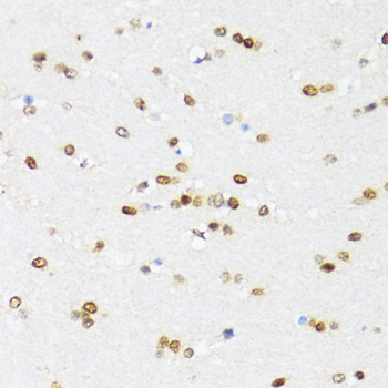 DDX21 Rabbit Polyclonal Antibody - Image 3