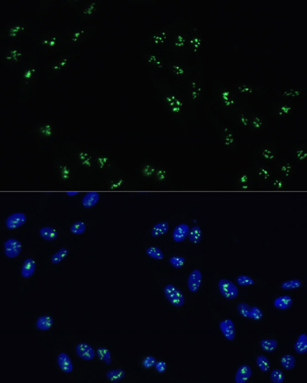 DDX21 Rabbit Polyclonal Antibody - Image 4