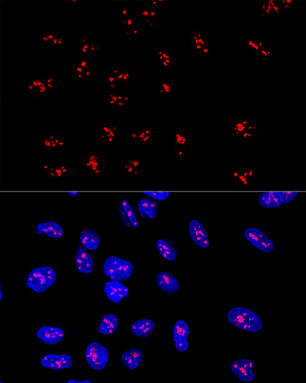 DDX21 Rabbit Polyclonal Antibody - Image 5
