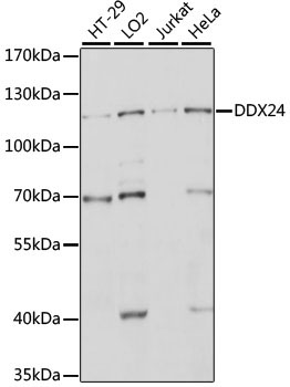 DDX24 Rabbit Polyclonal Antibody