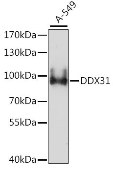 DDX31 Rabbit Polyclonal Antibody