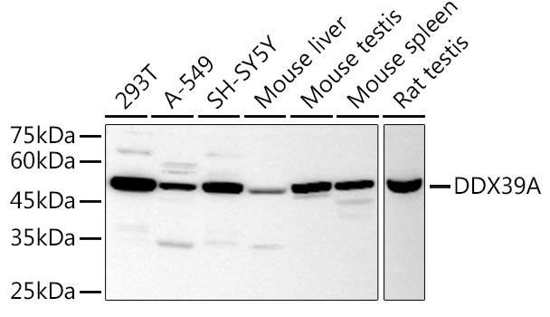 DDX39A Rabbit Polyclonal Antibody