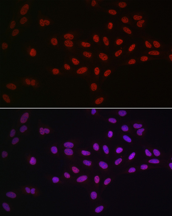 DDX39A Rabbit Polyclonal Antibody - Image 2