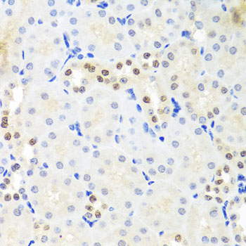 DDX39A Rabbit Polyclonal Antibody - Image 3