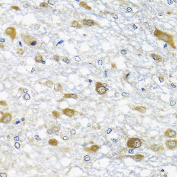 DDX39A Rabbit Polyclonal Antibody - Image 4
