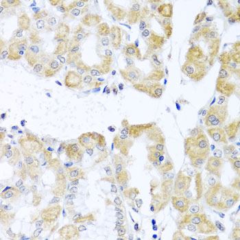 DDX39A Rabbit Polyclonal Antibody - Image 5
