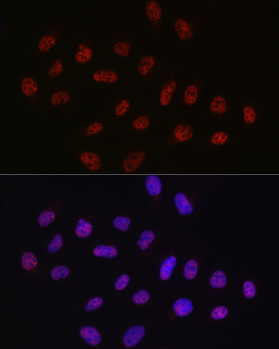 DDX39A Rabbit Polyclonal Antibody - Image 6