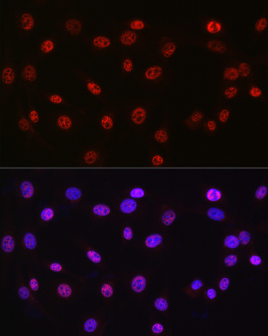 DDX39A Rabbit Polyclonal Antibody - Image 7