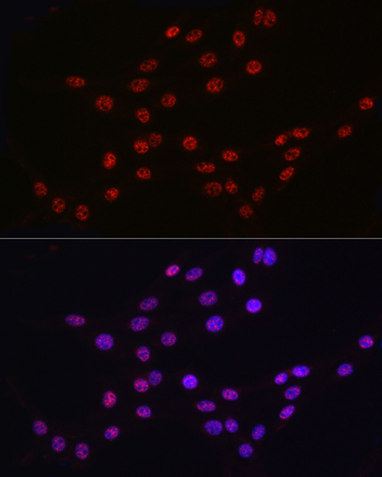 DDX39A Rabbit Polyclonal Antibody - Image 8