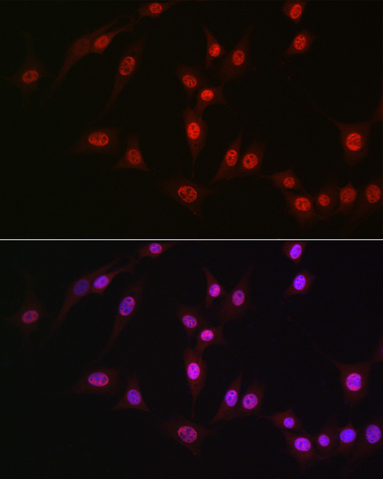 DDX39A Rabbit Polyclonal Antibody - Image 9