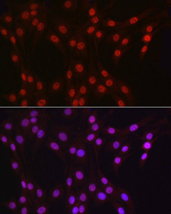 DDX39A Rabbit Polyclonal Antibody - Image 10